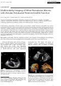 Cover page: Multimodality imaging of mitral perivalvular abscess with annular fistula and preserved leaflet function.